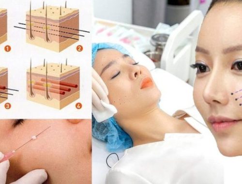 cang-da-mat-bang-chi-collagen-900x473