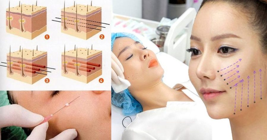 cang-da-mat-bang-chi-collagen-900x473