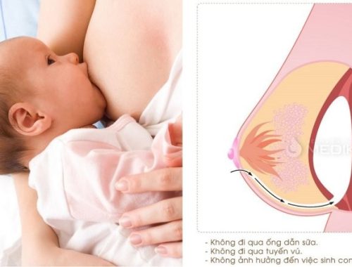 nâng ngực có cho con bú được không