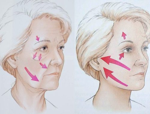 bác sĩ căng da mặt giỏi tại việt nam