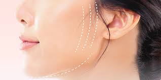 bác sĩ nào căng da mặt an toàn