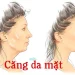 căng da mặt có sẹo không