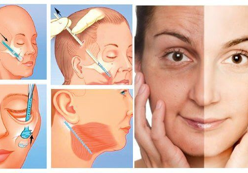 căng da mặt có tác dụng gì