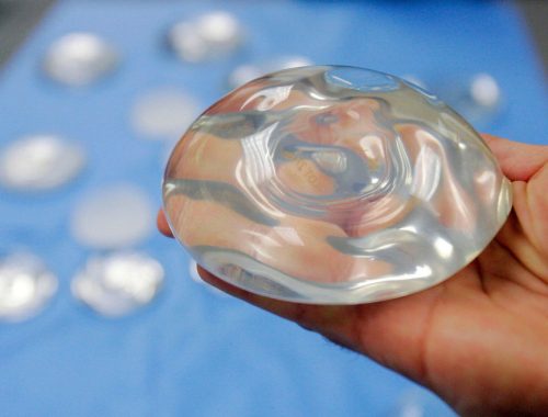 túi nâng ngực bao nhiêu tiền