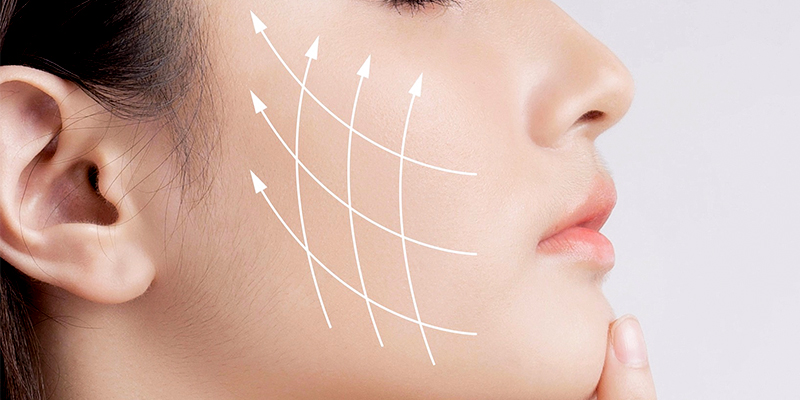 căng da mặt 1 bên