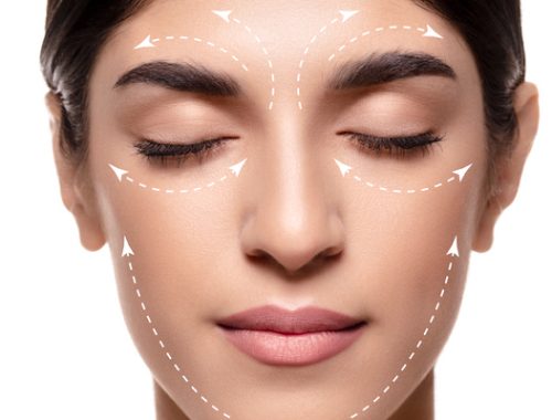 căng da mặt sau này có phải căng lại không