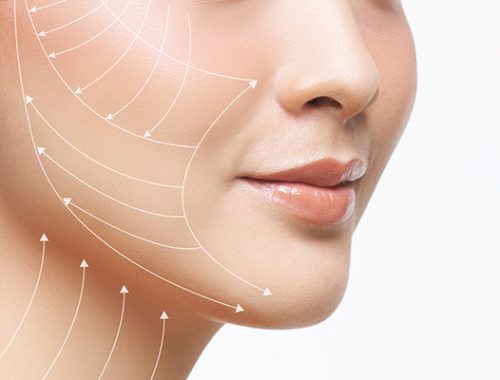căng da mặt có tốt không